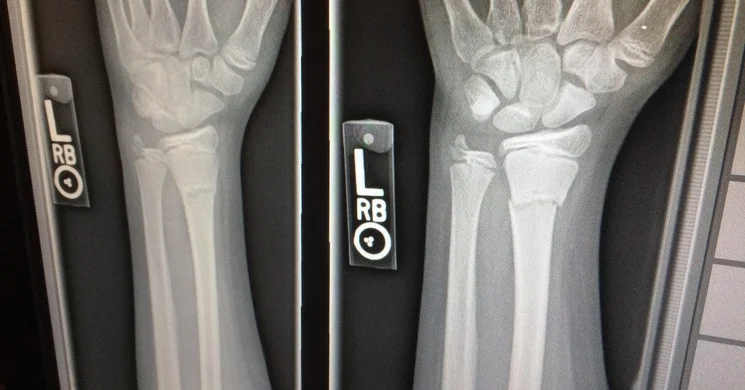 November 8. A radiológiai nemzetközi napja